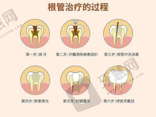 不同原因导致的牙齿松动，这样治疗才能“固齿”