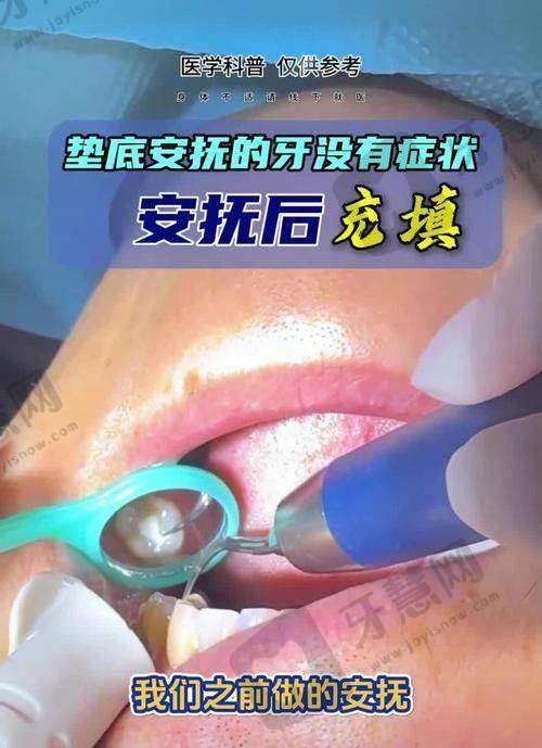 牙齿松动程度自测:3个等级帮你判断是否需要“紧急就医”
