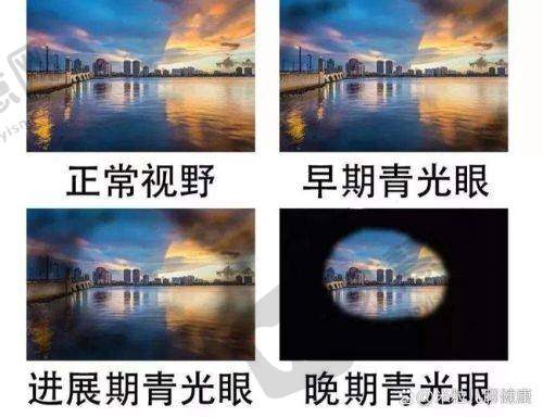 哈尔滨市北方人民医院眼科医生简介