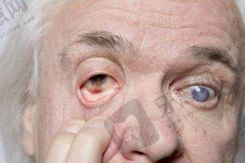 哈尔滨第二一一医院眼科口碑好不好？附真实患者口碑评价