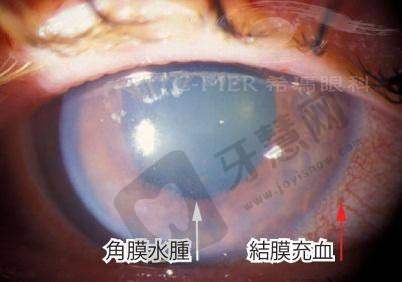 黑龙江省中医医院眼科