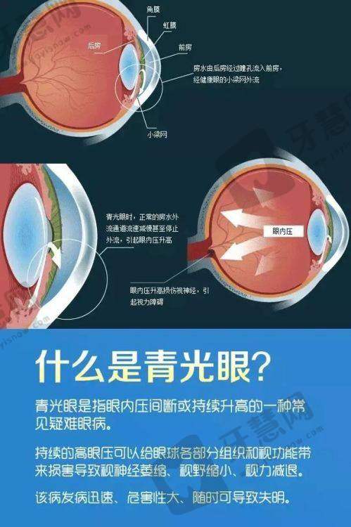 哈尔滨市阿城区人民医院眼科地址及乘车路线