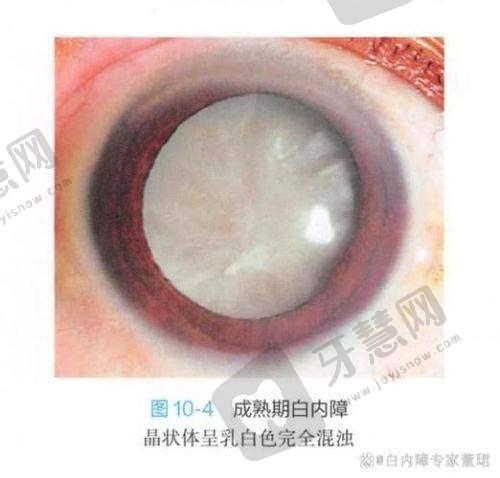 三、哈尔滨市眼科医院怎么样,口碑评价如何?