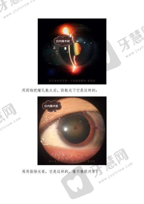 哈尔滨第二一一医院眼科价格表