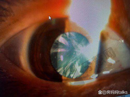 哈尔滨市中医医院眼科怎么样，口碑评价如何？