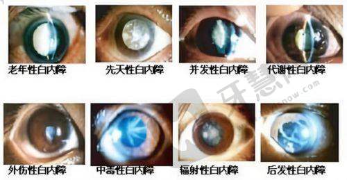 哈尔滨市中医医院眼科口碑好不好?附真实患者口碑评价