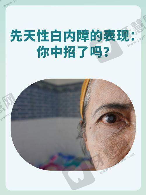 哈尔滨市中医医院眼科项目特色