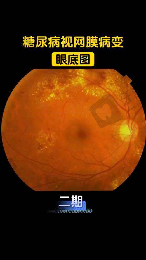 哈尔滨第二一一医院眼科地址及乘车路线