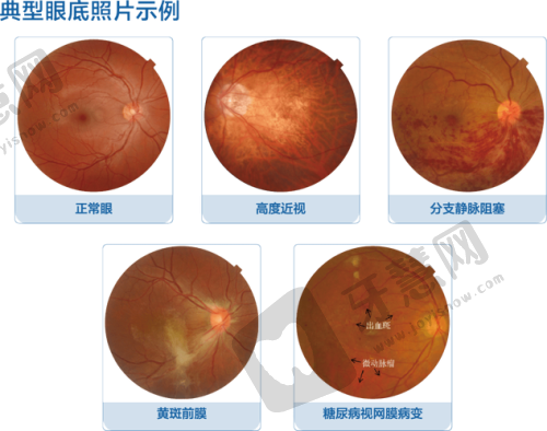 七、哈尔滨市眼科医院口碑好不好?附真实患者口碑评价