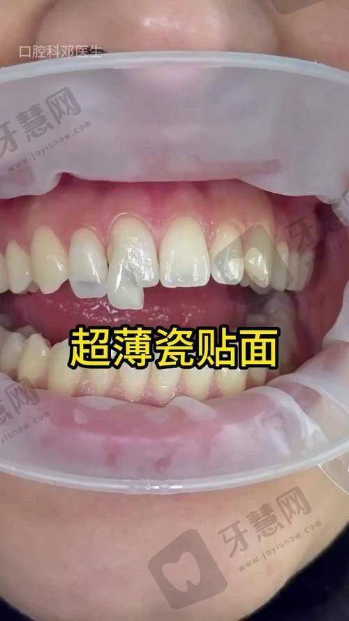 总结：口腔科免费询问，让看牙从此“不踩坑、少花钱”