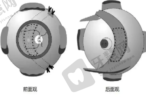 理性提醒:姐妹们,变得更美也要“稳中求胜”!