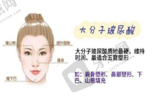 热门项目体验：全科整形项目，术后反馈积极