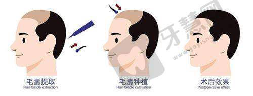 西安高一生医疗美容医院靠谱吗？隆鼻医生金磊口碑评测及真实体验分享攻略
