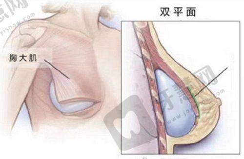生物补片对性功能有影响吗？男科医生拆解5类真实反馈  