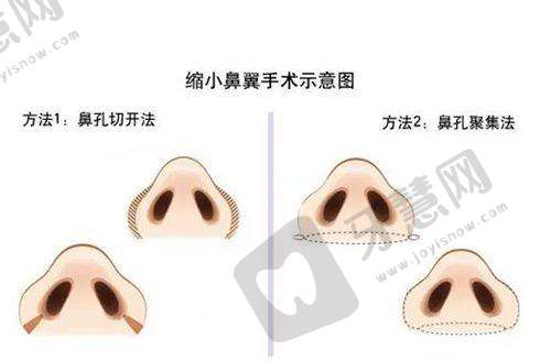 9. 拓展信息