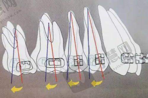 石家庄牙博士口腔儿童MRC早期干预8000元起技术优势