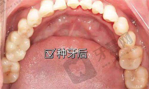 结尾