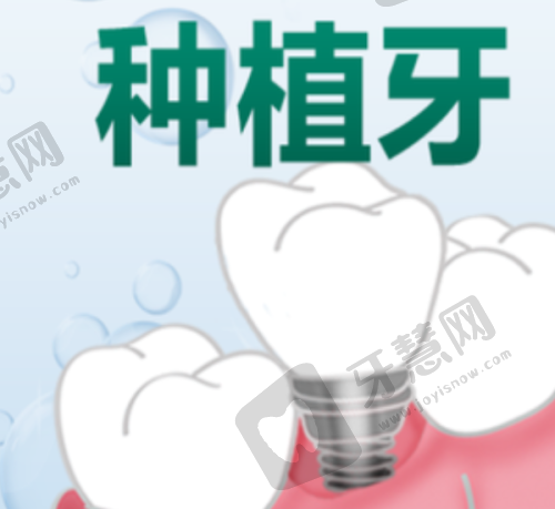 南昌大学附属口腔国产创英种植牙 2700 元起顾客实例