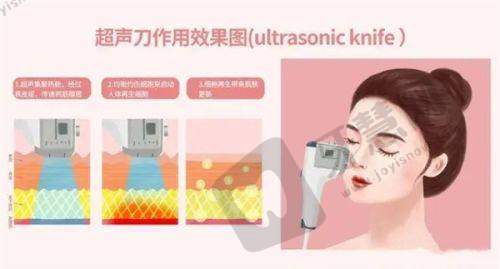 理性提醒:生物补片增大费用不是“仅此标准”