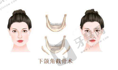 4. 维持时间：长久抗衰的奥秘