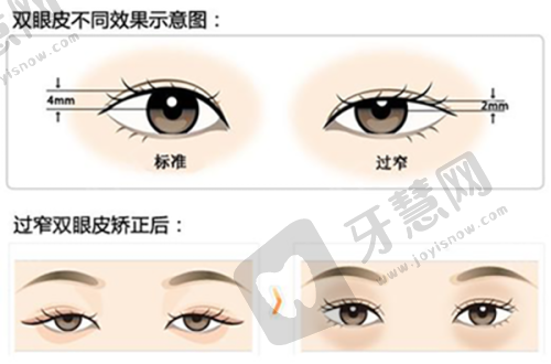 五、做一次到底要花多少钱？26000 - 52000元的价格里，藏着这些“猫腻”
