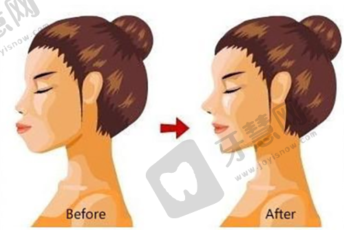 生物补片增大费用:成效和钱成正比吗?2万和6万的真实差距