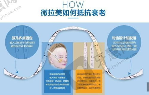 10年持久度靠谱吗?真皮补片“存活”的3个关键:材料、手术、术后护理