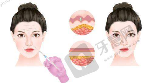 阴茎上长疙瘩是什么病症？诱因三：性传播疾病——「高危行为后出现这些疙瘩要警惕」