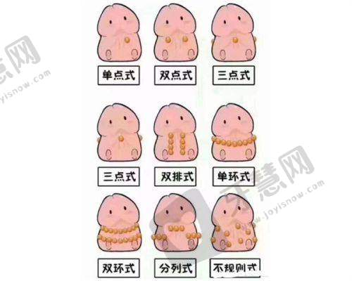 四、广州健丽去眼袋的手术过程与术后修复
