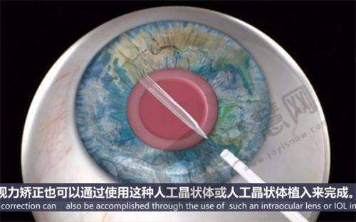 徐州市第一人民医院眼科地址专精医生信息