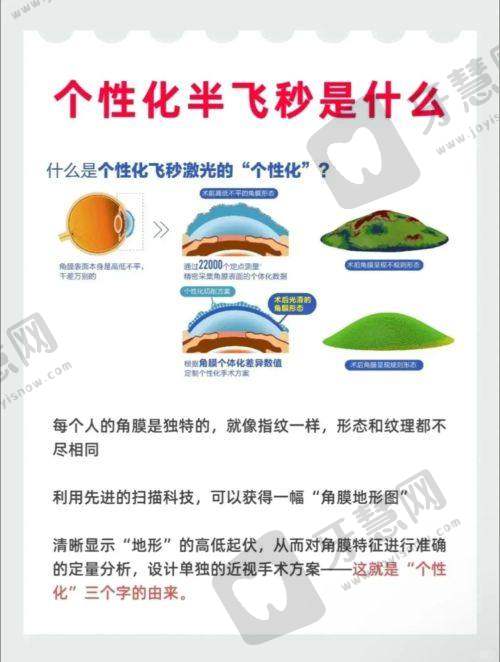 总结赣州日本目立康圆锥Z - E1 RGP收费表2025