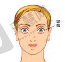 佩戴角膜塑形镜的成效感受