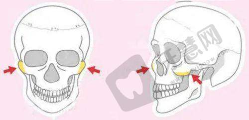 真皮补片vs玻尿酸vs真皮粉末:增粗成效&持久度PK,选哪个不后悔?