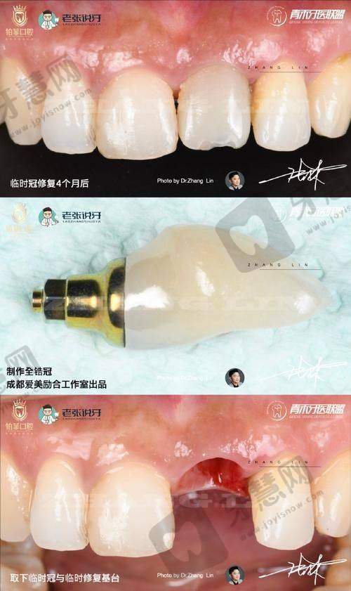 广东省口腔医院口碑如何