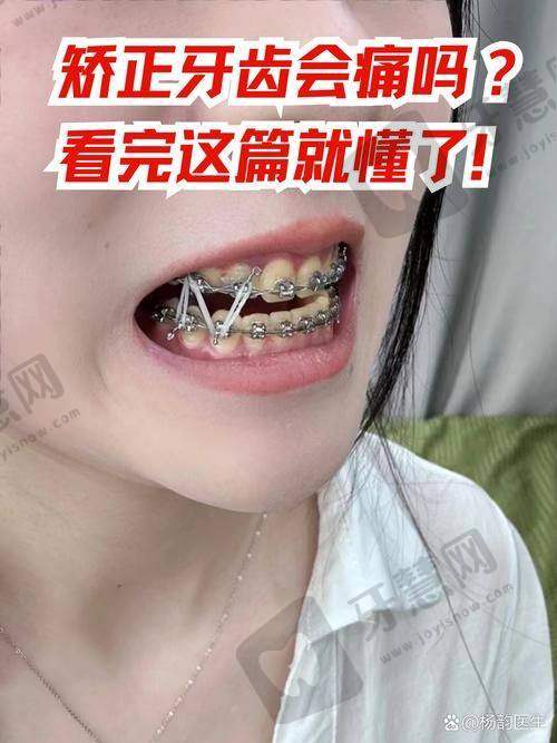 石家庄永齐口腔深覆合隐形矫正 27200 元起项目简介