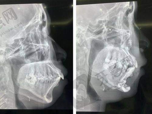 广东省口腔医院怎么样?
