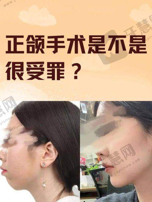医院收费贵吗？