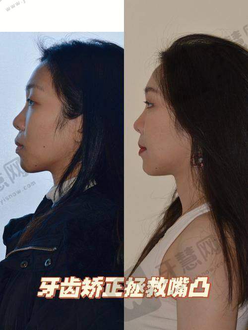 北京大学口腔医院地址电话