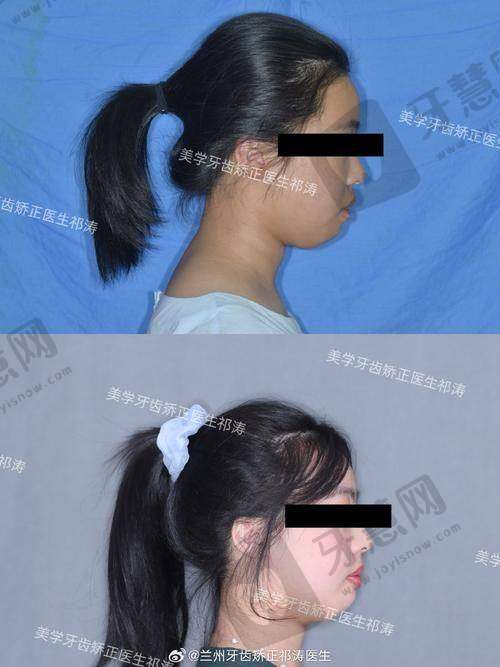 三、深圳市龙华区人民医院口腔科是国有的还是私立的?