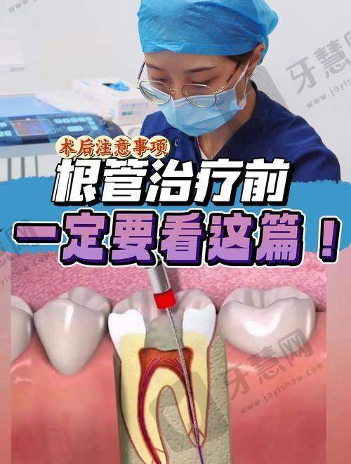 超薄全瓷贴面寿命的3大“隐形杀手”——90%的人都踩过坑