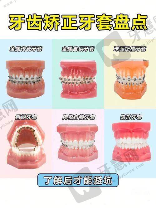 【儿童齿科患者评价】