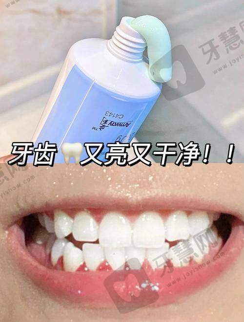 总结：超薄全瓷贴面的优缺点权衡与理性选择建议