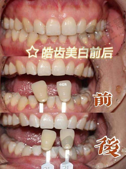 深圳市口腔医院价格表