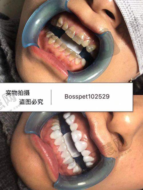 深圳市第六人民医院(南山医院)口腔科口碑如何