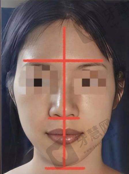 4. 多学科联合诊疗(MDT)
