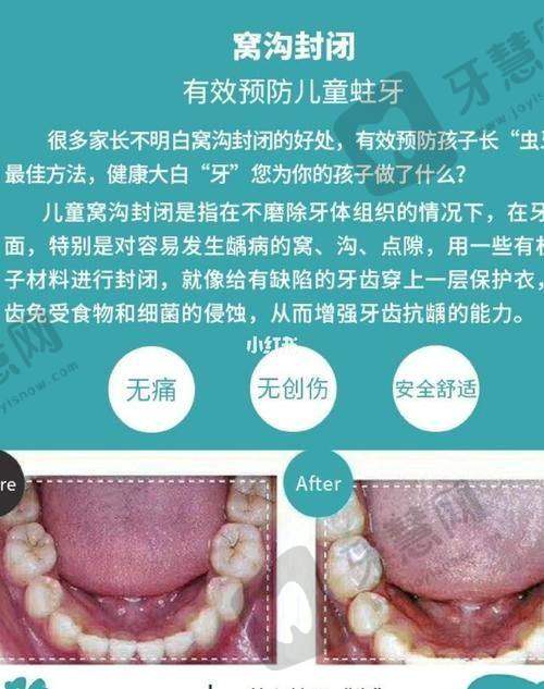 华中科技大学协和深圳医院口腔科口碑如何