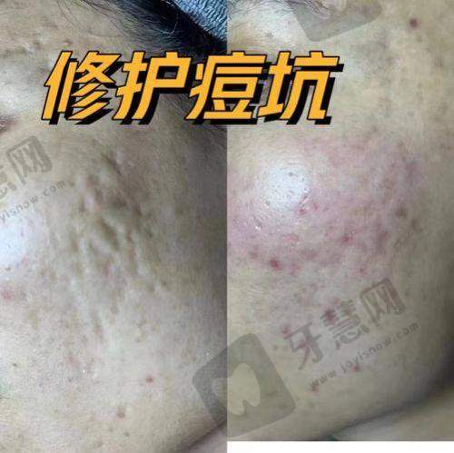 一、2025年主流手术方式：费用差10倍，修复时间差3倍，怎么选？