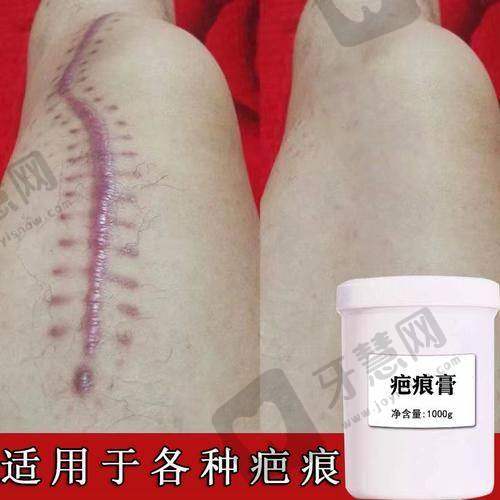 六、理性提醒：没有“一劳永逸”的医美，选对医院比“追低价”更重要