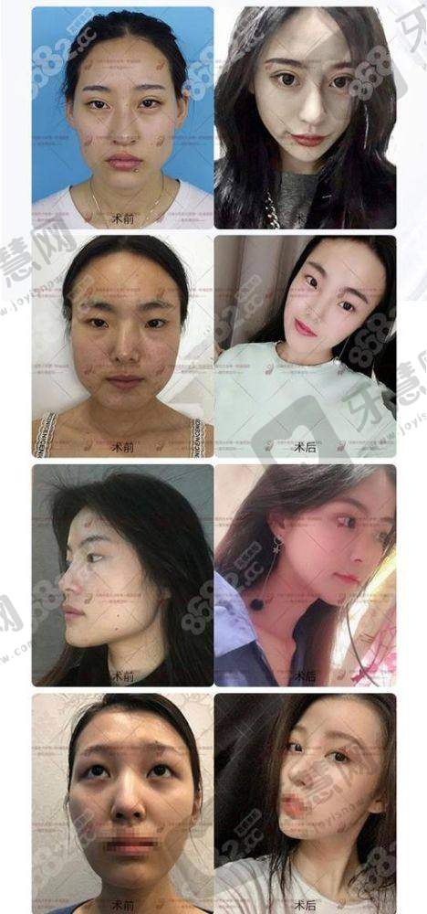价格亲民，性价比高，是“医美之都”的实力代表