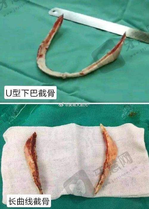 正颌手术实力强劲，重庆推荐医生榜上有名